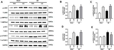 Liquiritin Attenuates Pathological Cardiac Hypertrophy by Activating the PKA/LKB1/AMPK Pathway